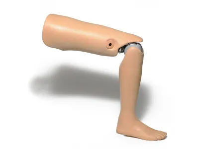 Orthotec Orthopädietechnik Prothesen Knieexartikulations Prothesen Massanfertigung