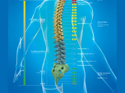 laehmungshoehe-paraplegie