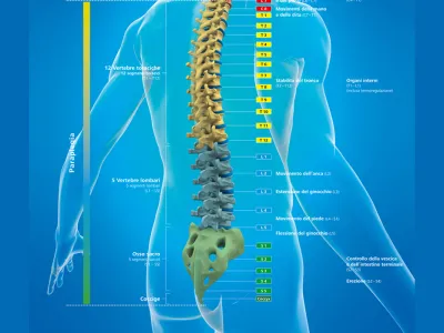 laehmungshoehe-paraplegie
