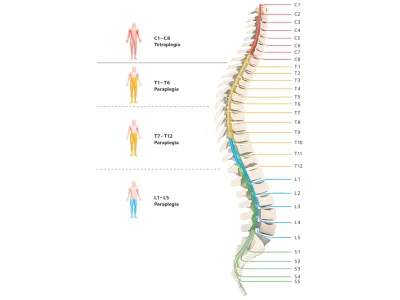 wirbelsaeule-unterteilt-paraplegie-tetraplegie