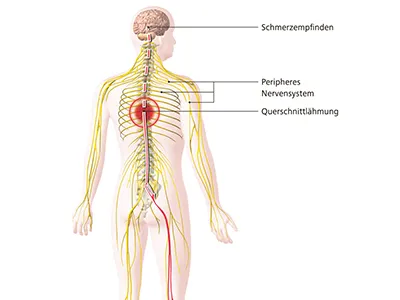 Schmerzwahrnehmung bei QL