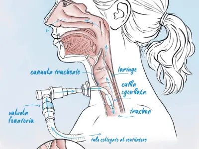 illustrazione