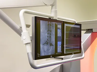 Röntgenbild der Neuro-Urologie am Schweizer Paraplegiker-Zentrum