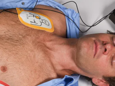 Ein Mann liegt bewusstlos auf dem Boden mit Defibrillation Pads auf der Brust BLS AED SRC SIRMED