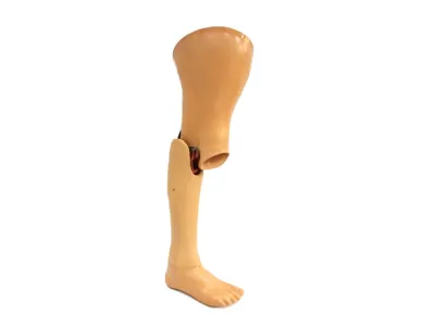 Orthotec Orthopädietechnik Orthoprothesen Massanfertiung Oberschenkel
