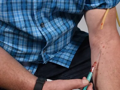 Vergiftung durch Drogen