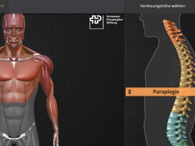 Visualisierung Querschnittlähmung - Schweizer Paraplegiker-Zentrum