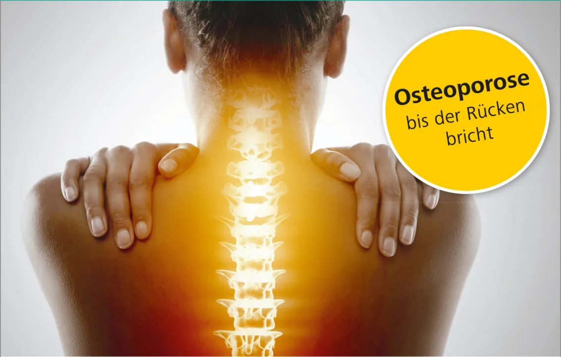 Rückenforum "Osteoporose: bis der Rücken bricht": Schweizer Paraplegiker Zentrum am 18. März 2020