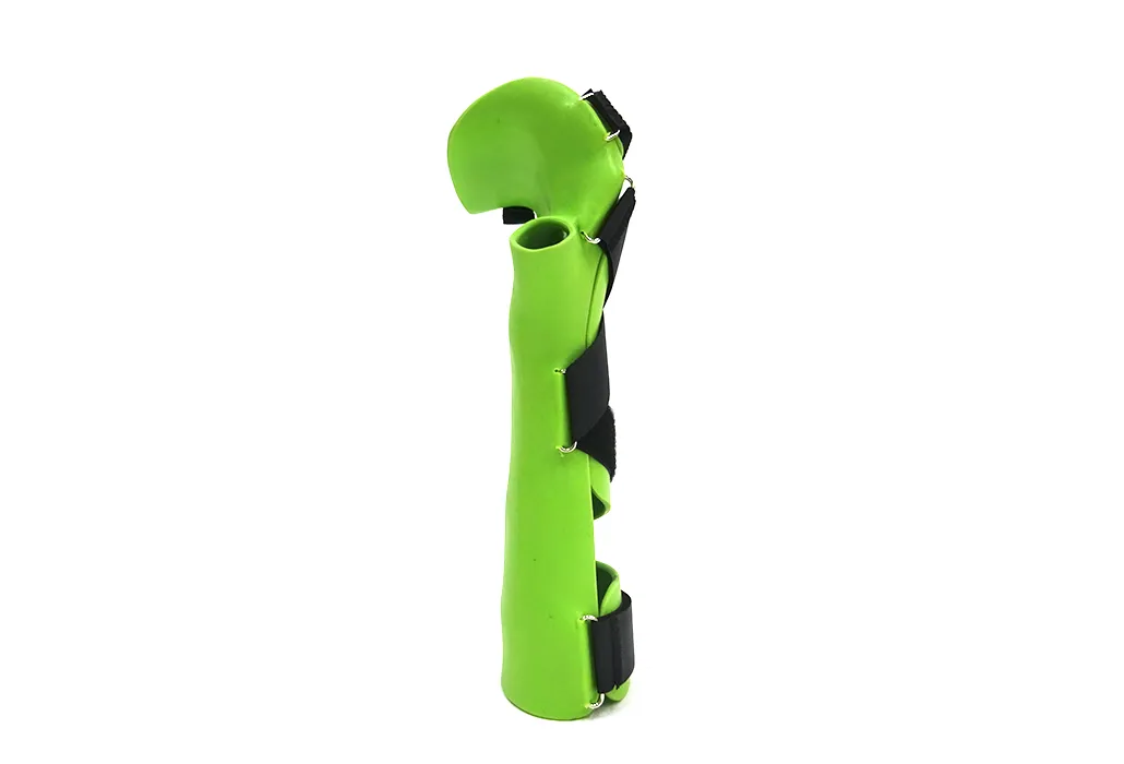 Orthotec Orthopädietechnik Orthesen Unterarmorthesen Massanfertigung Silikon Lagerungsorthese