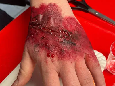 Schnelle Moulage mit Klebstreifen