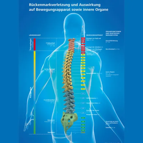 Rückenmarkverletzungen -Darstellung
